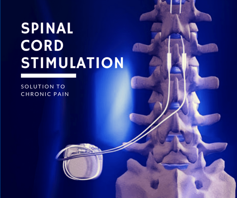 Spinal Cord Stimulator: Saving Grace or to be Continued? By Dr. George Ackerman