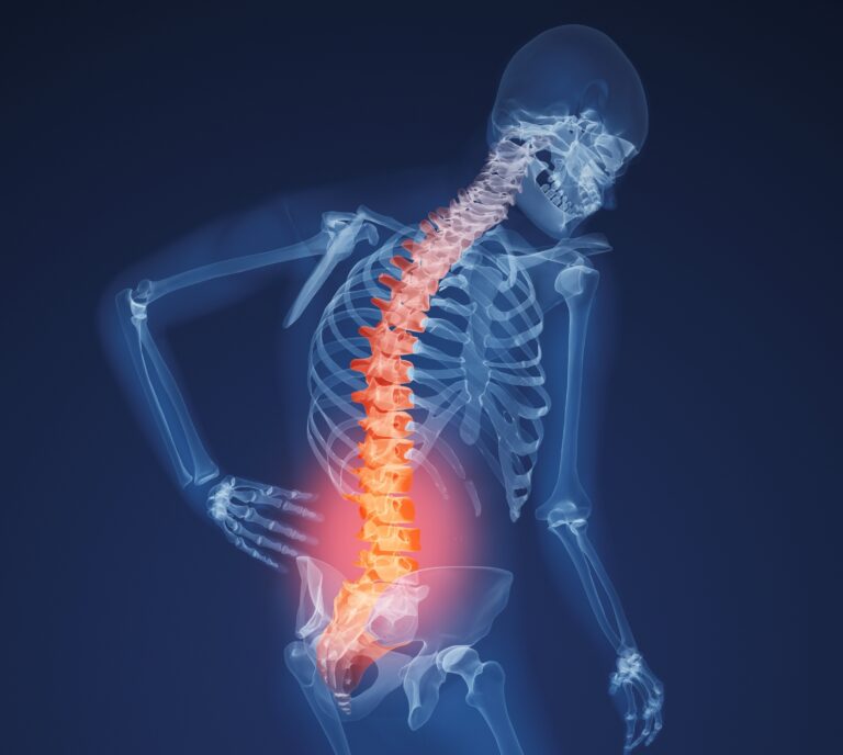 Spine Cord Stimulator Journey… By Dr. George Ackerman